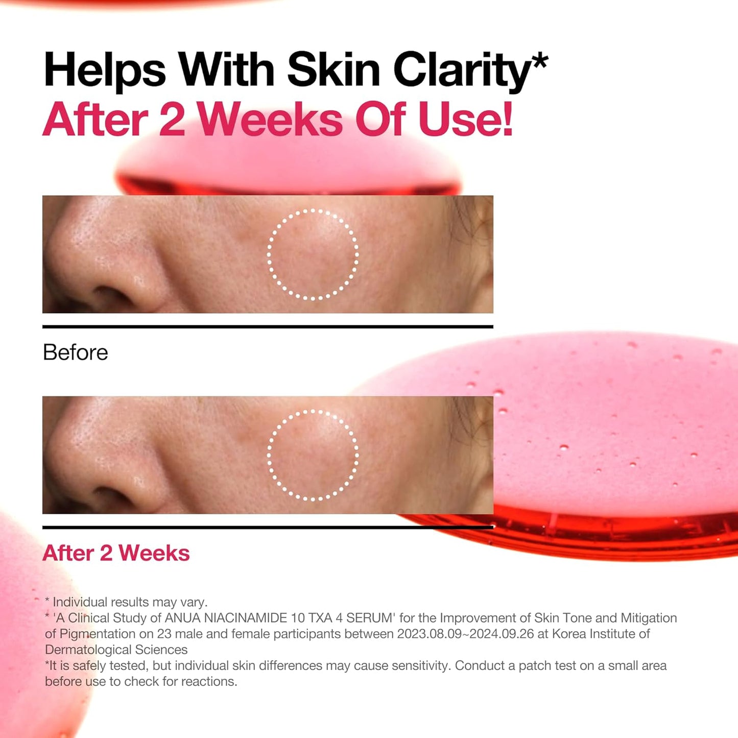 30ml Niacinamide 10 TXA 4 Serum Nicotinamide 10 TXA 4