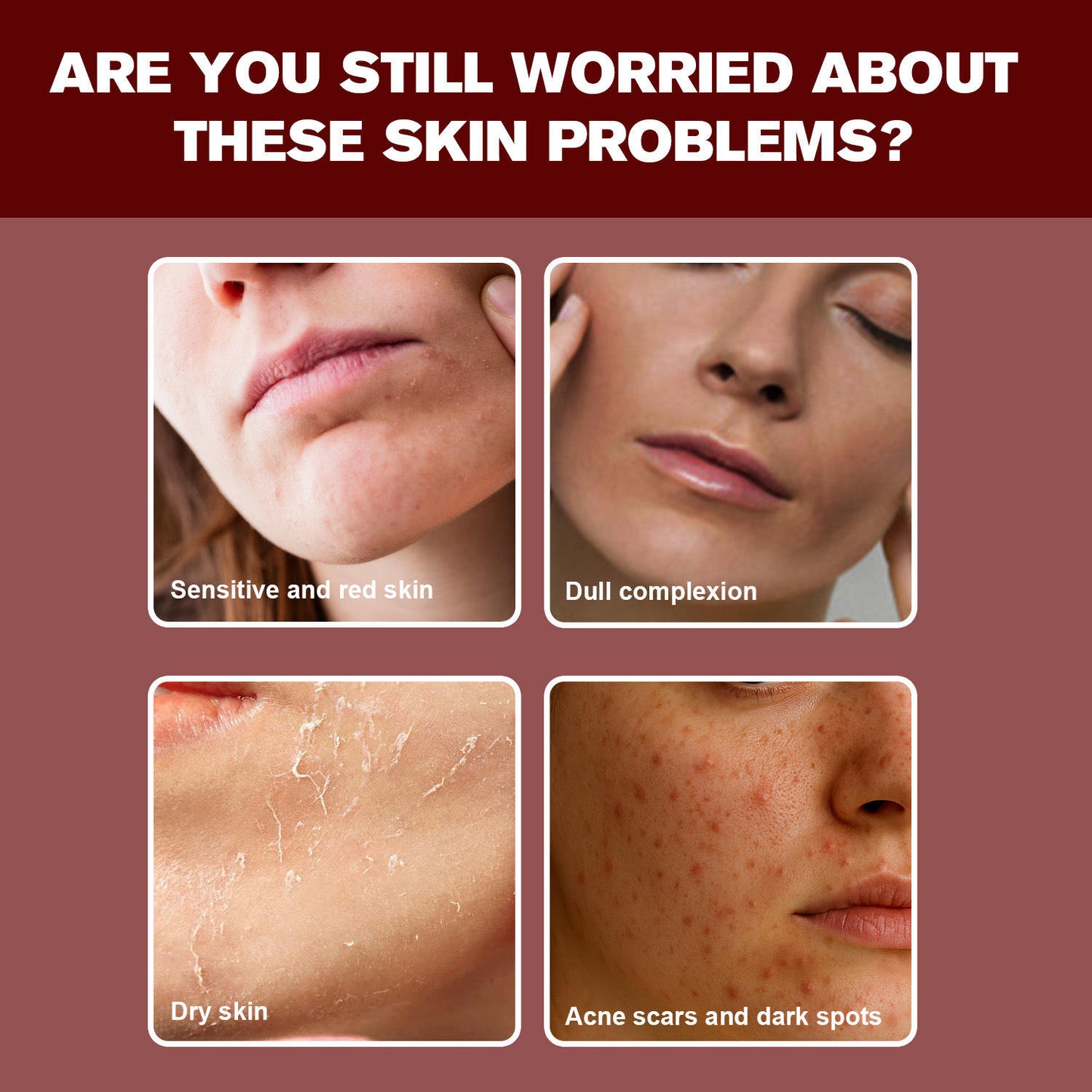 30ml Niacinamide 10 TXA 4 Serum Nicotinamide 10 TXA 4